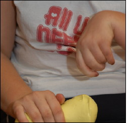 putty being used during physiotherapy sessions